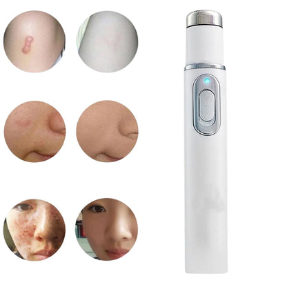 Blue Light Laser Skin Pen for Targeted Spot and Blemish Appearance Care