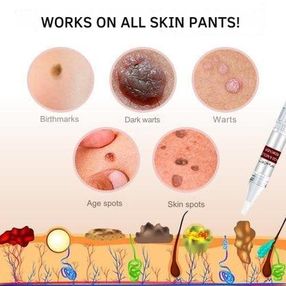Skin Tag and Wart Remover Pen with Precision Brush Tip