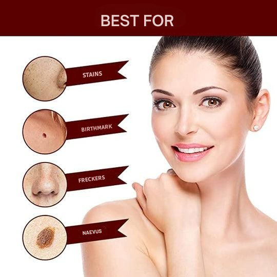 Skin Tag and Wart Remover Pen with Precision Brush Tip