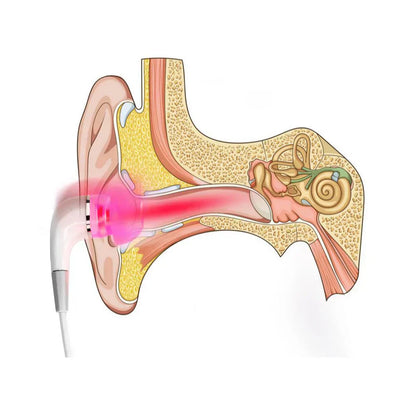 Tinnitus Relief Sound Therapy Earplugs – Comfortable Earplugs for Calm and Relaxation